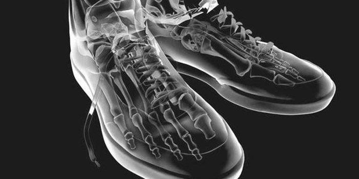 Röntgentekening van voetbotjes in schoenen